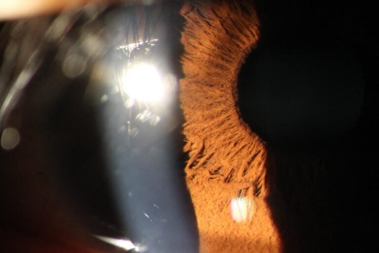 How to choose the best eye photography machine a complete buying guide.jpg