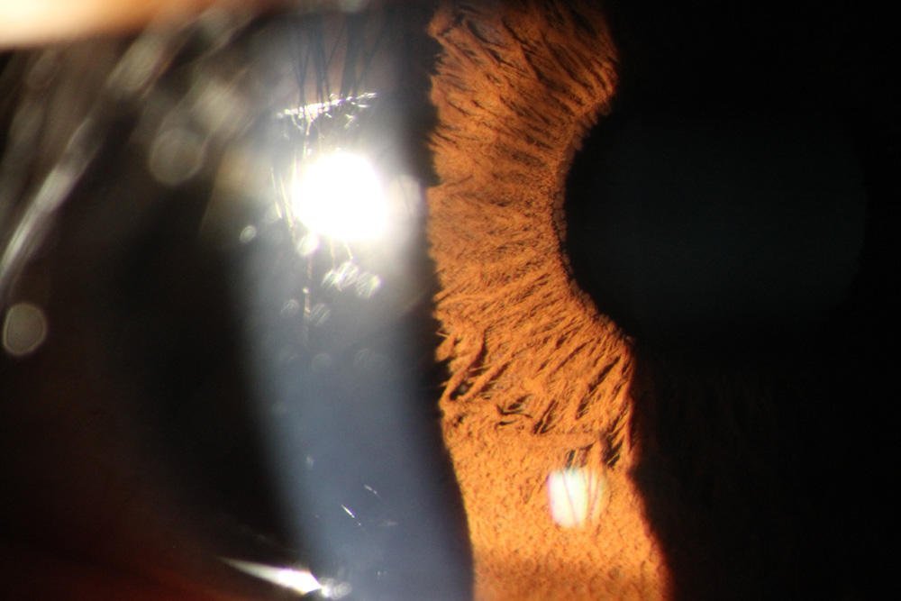 How to choose the best eye photography machine a complete buying guide.jpg