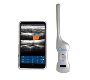 How to choose the best ultrasound head for your needs.jpg